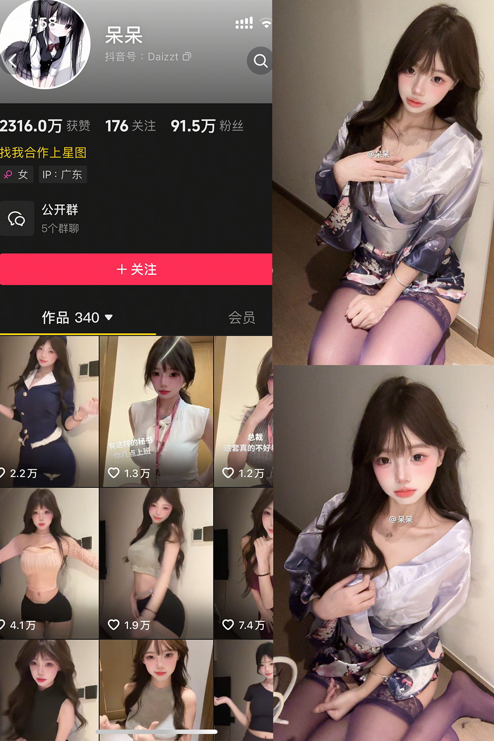 抖音 呆呆 微密圈照片资源 NO.004期 【6P】最新至：2025.5.3