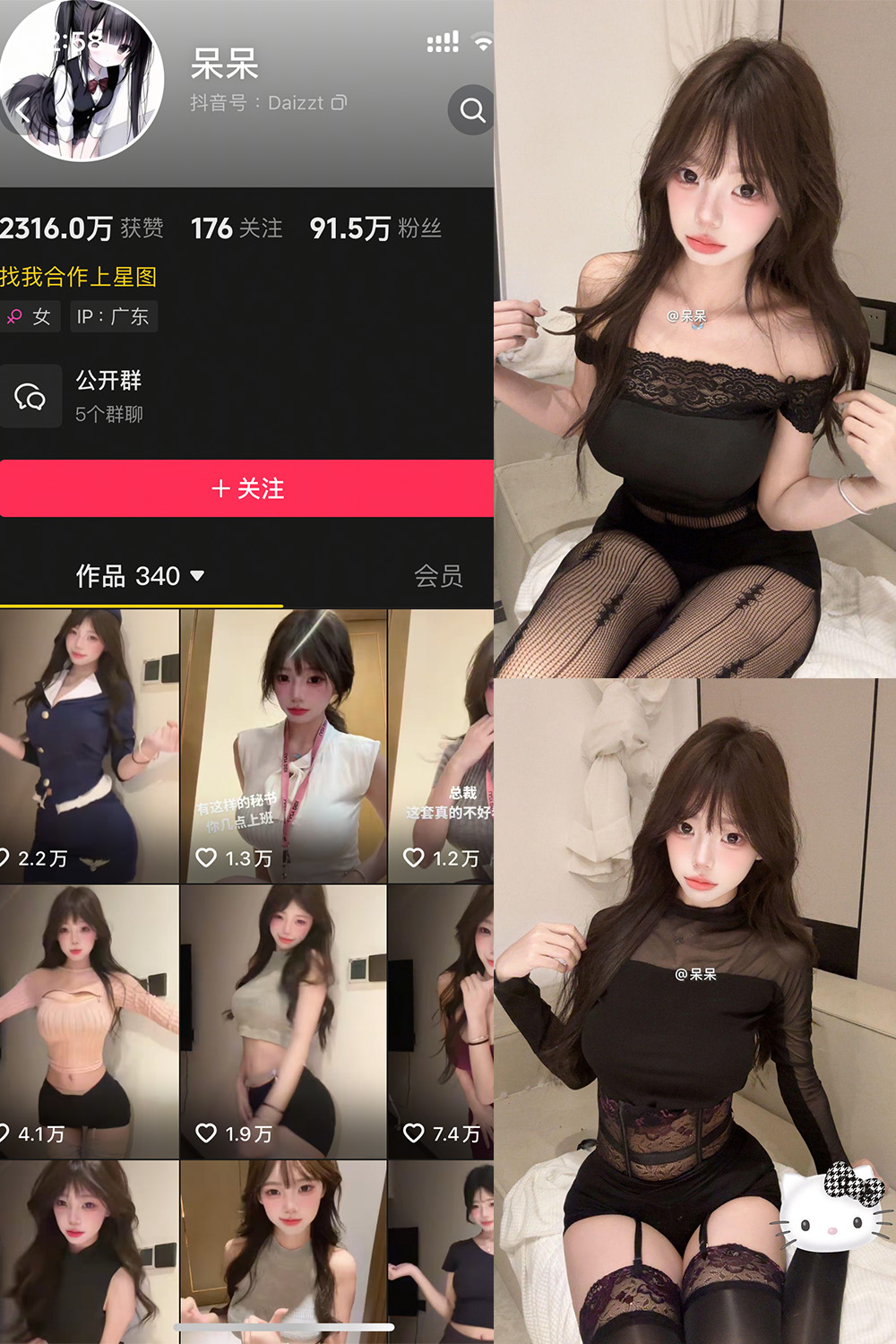 抖音 呆呆 微密圈照片资源 NO.007期 【8P1V】最新至：2025.5.13