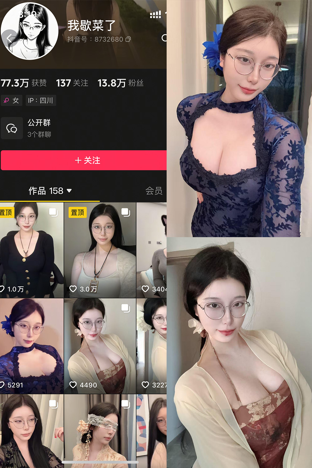 抖音 我歇菜了 微密圈照片资源 NO.001期 【10P】最新至：2025.4.19