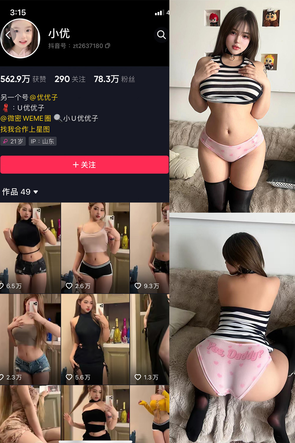 抖音 小U优优子 VIP 微密圈照片资源 NO.061期 【20P1V】最新至：2025.4.25